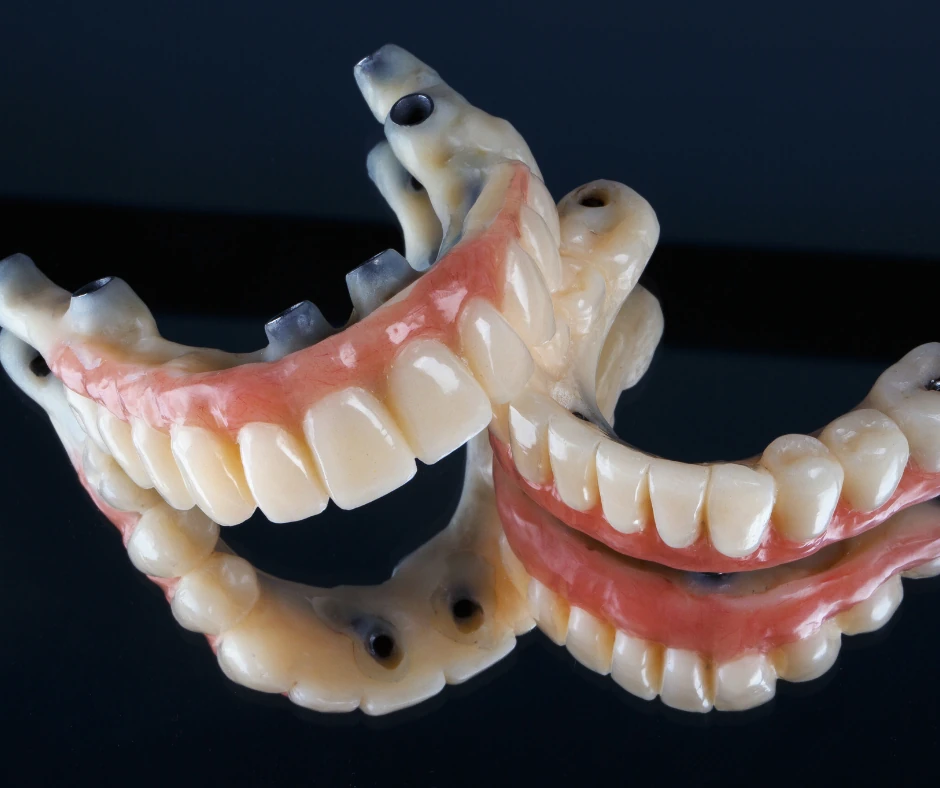 Pterygoid Implants