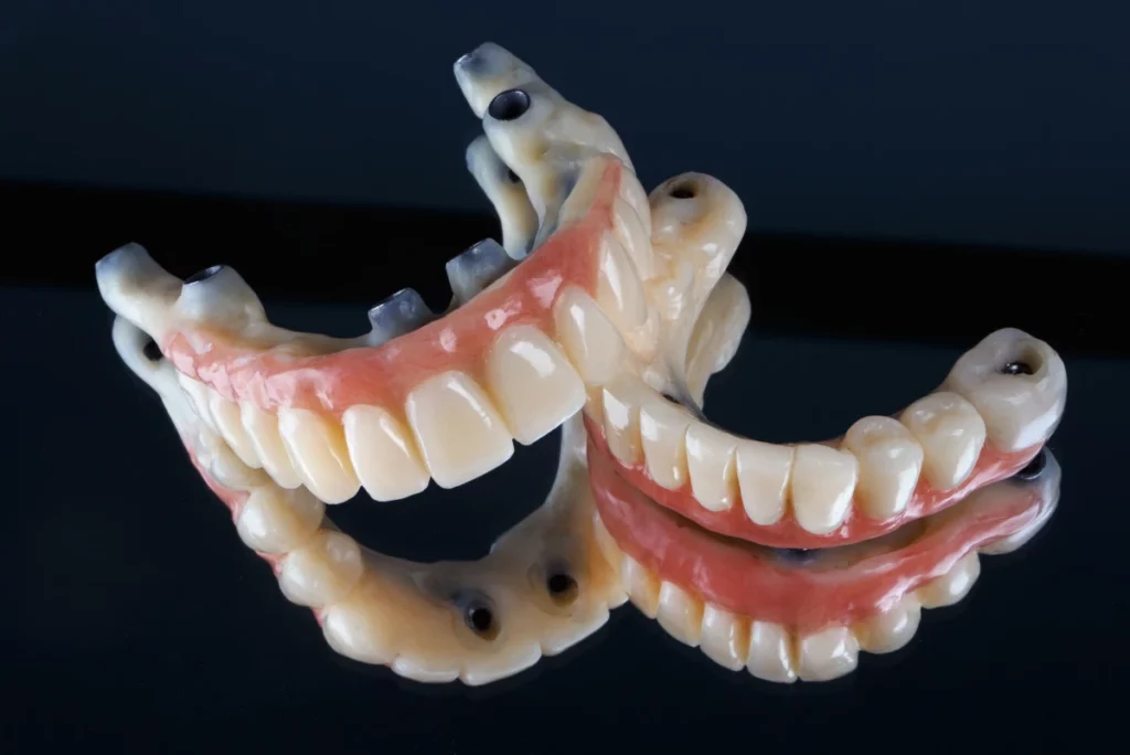 Two dental implants