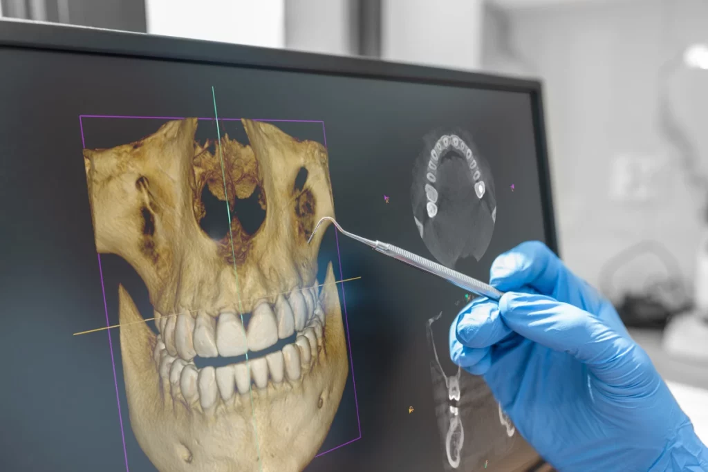 3D Scan of Jaw and Lower Skull