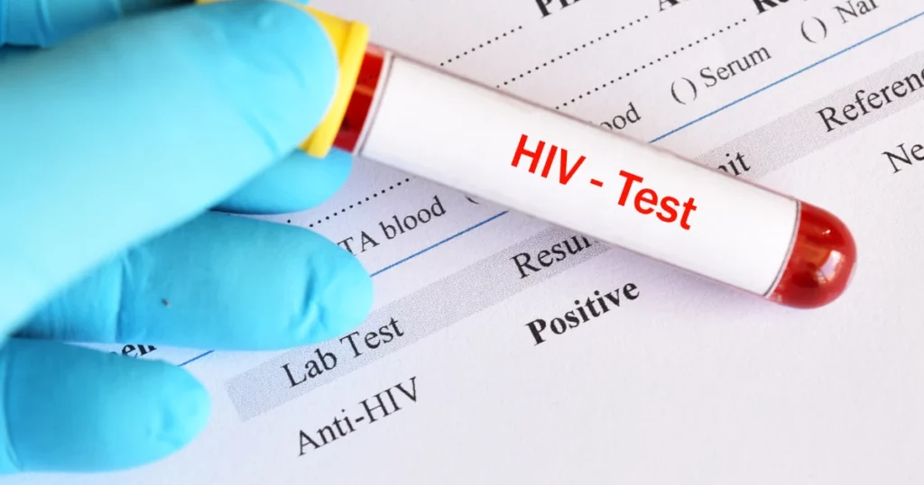 HIV test